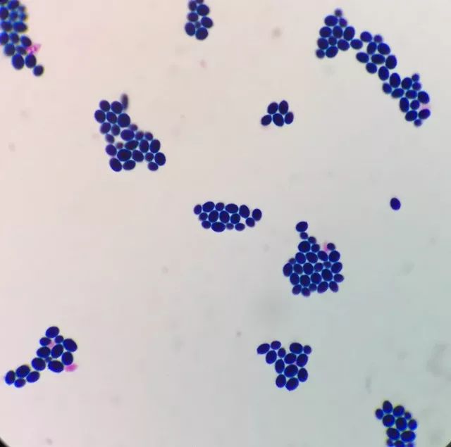 天呐，女儿大便里竟然有“霉菌”