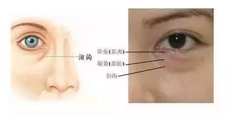 江阴去泪沟,女子花326万整容后续