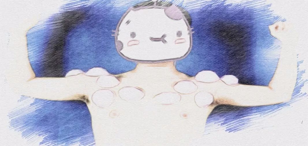 拔罐可以搞定哪些小毛病,拔罐疗法的适应症和作用