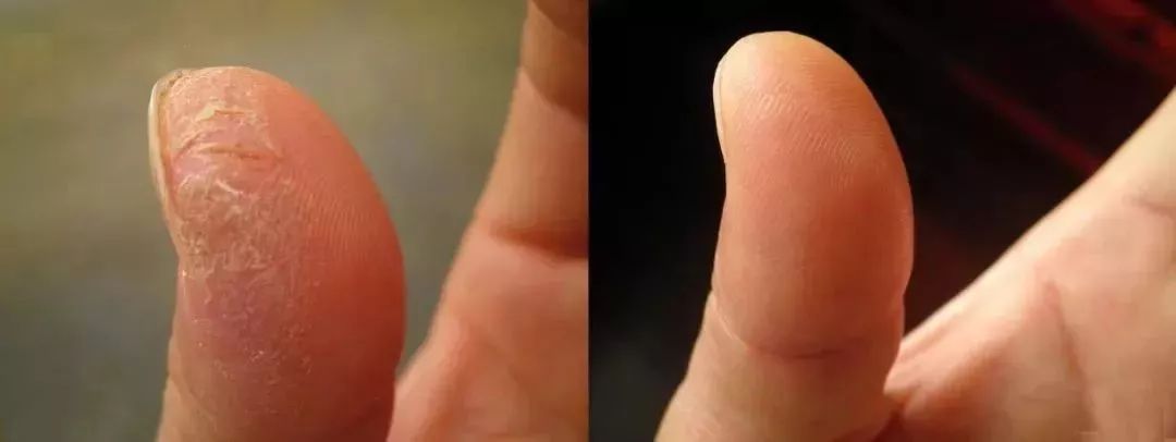 一天洗无数次手，记得要这么做