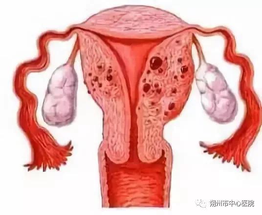 哪些妇科疾病需要进行手术治疗,微创介入治疗妇科疾病