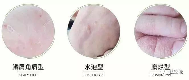 脱鞋不可怕，谁臭谁尴尬！臭脚丫的克星，喷一喷，脚臭无影无踪