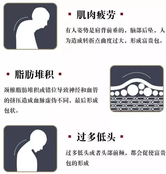 低头族的福音10分钟缓解颈椎,一分钟学会肩颈按摩拯救低头族