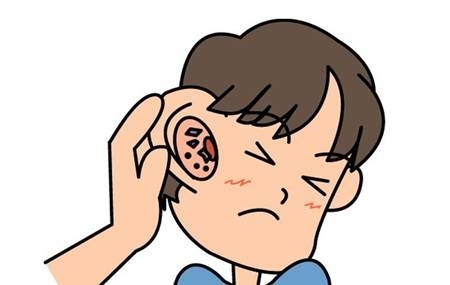 糠耳怎么会变成油耳,为什么有些人是油耳有些人是干耳