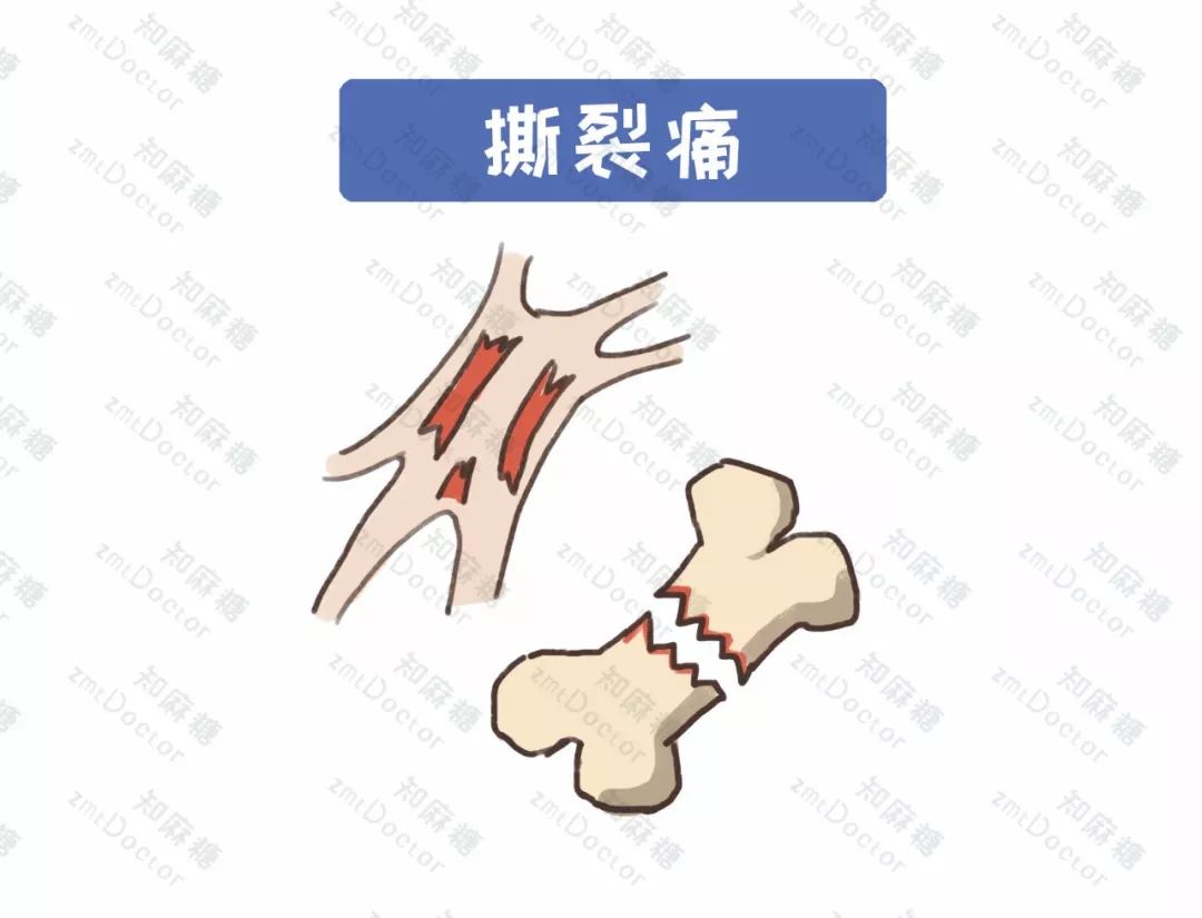 世界镇痛日摆脱疼痛杜绝亚健康,世界镇痛日主题