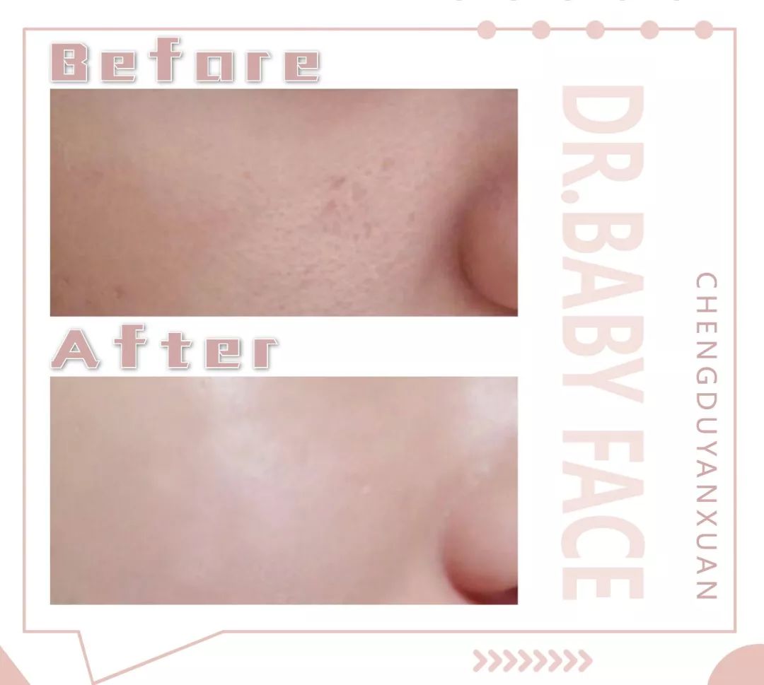 想要素颜美瓷肌,重回十七八岁童颜时代,来这家诚意满满的店get净颜美肤的诀窍