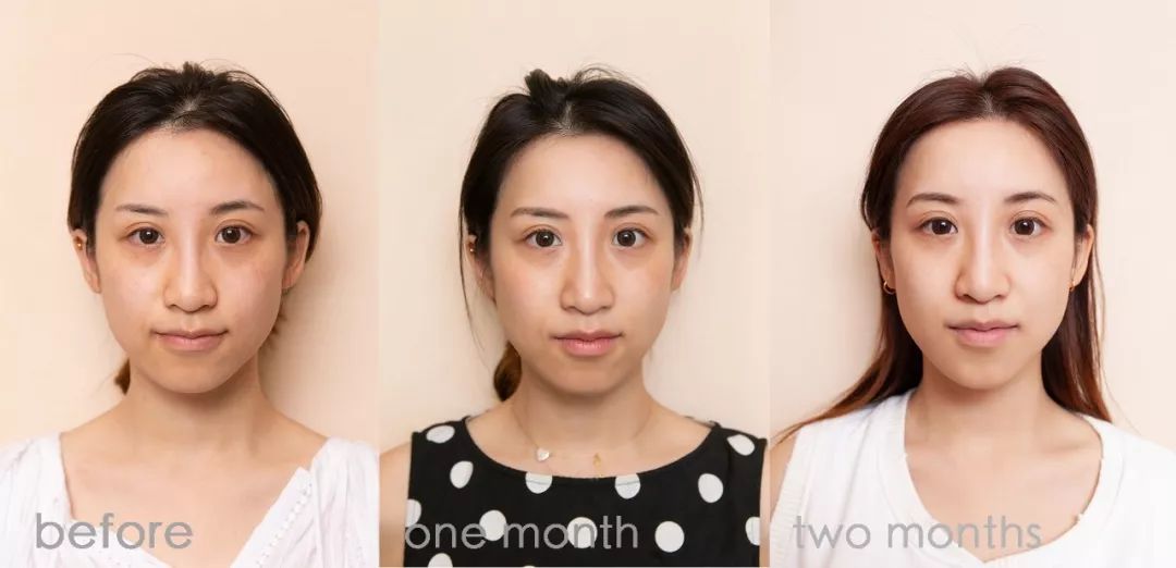 肌诊室水光肌挑战,肌诊室修复