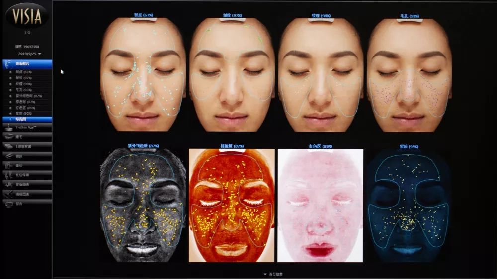 肌诊室水光肌挑战,肌诊室修复