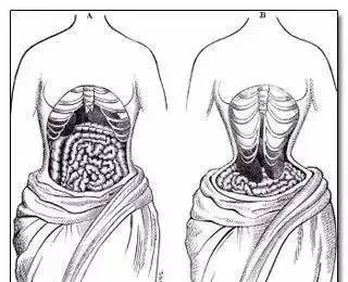400年前就该消失的瘦身垃圾，因为网红一吹，居然又火了