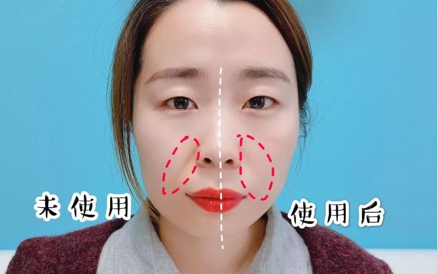 法令纹眼纹一个都逃不掉,法令纹和眼纹怎么才能有效改善