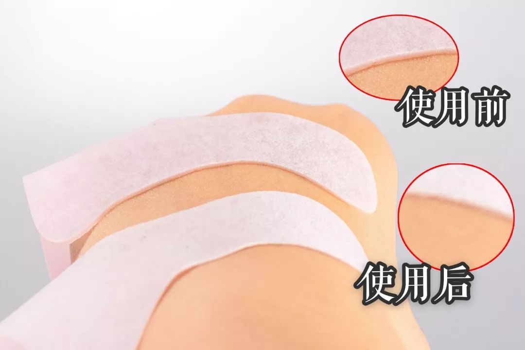 法令纹和眼纹怎么才能有效改善,法令纹贴眼贴有用吗