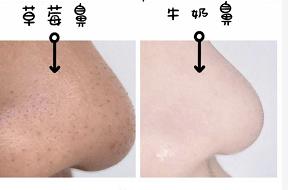 日本草莓鼻去黑头最有效的产品,byebye草莓鼻去黑头神器大揭秘