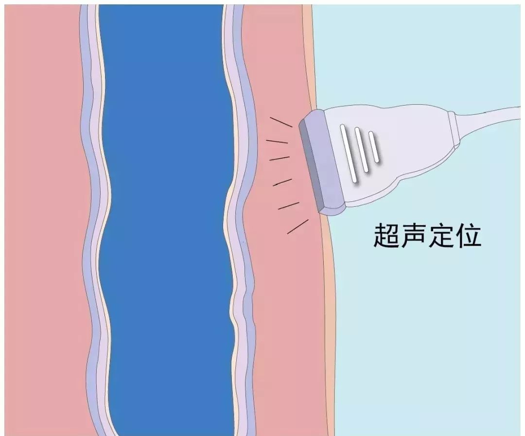 不得不防！大多数中老年人都有这个毛病生活中这些习惯要改掉......