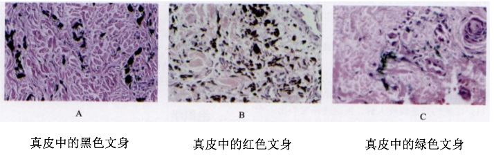 祛斑首选护肤品,祛斑最好的克星