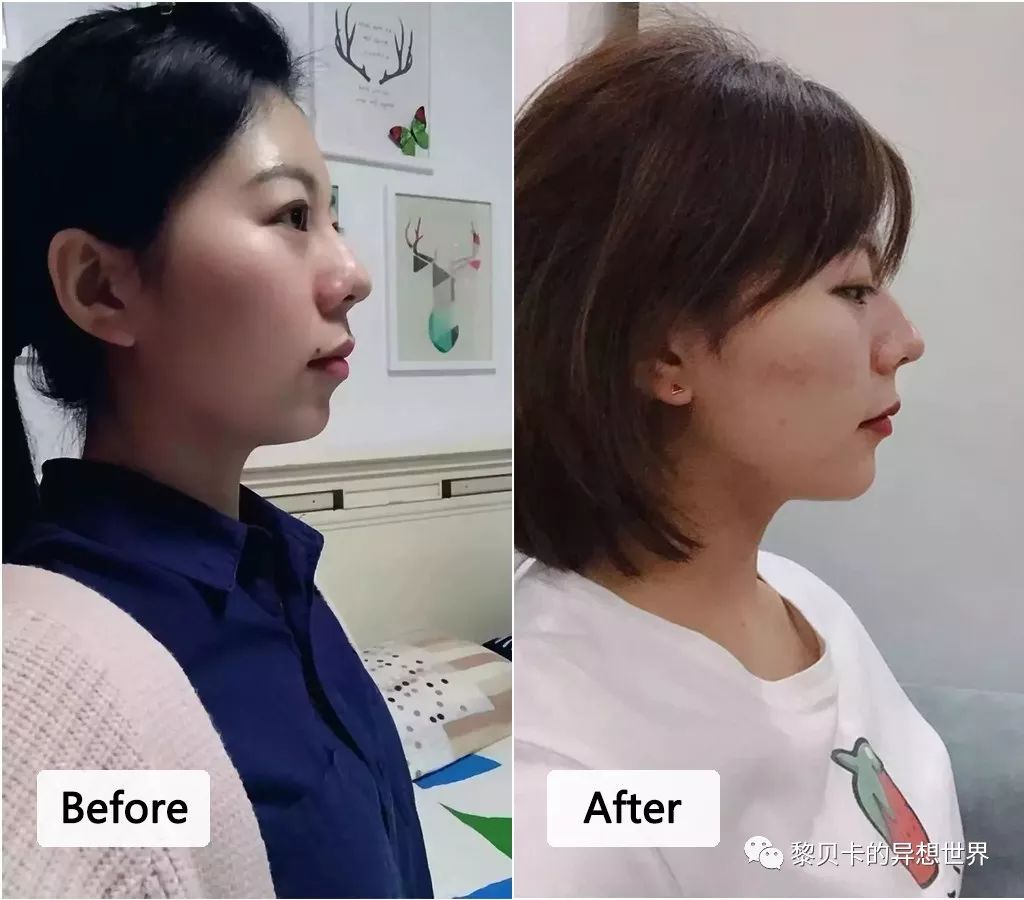 最短只要一年，这件事做对了堪比整容