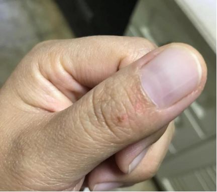 做饭过程中，燃气灶玻璃面板突然炸裂......老板电器：存在自爆几率，不是质量问题