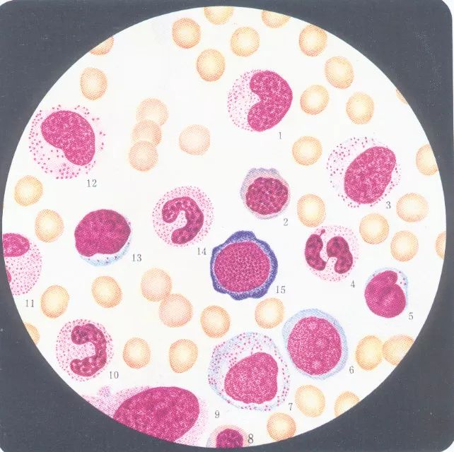 全血细胞减少疾病，你还傻傻分不清？