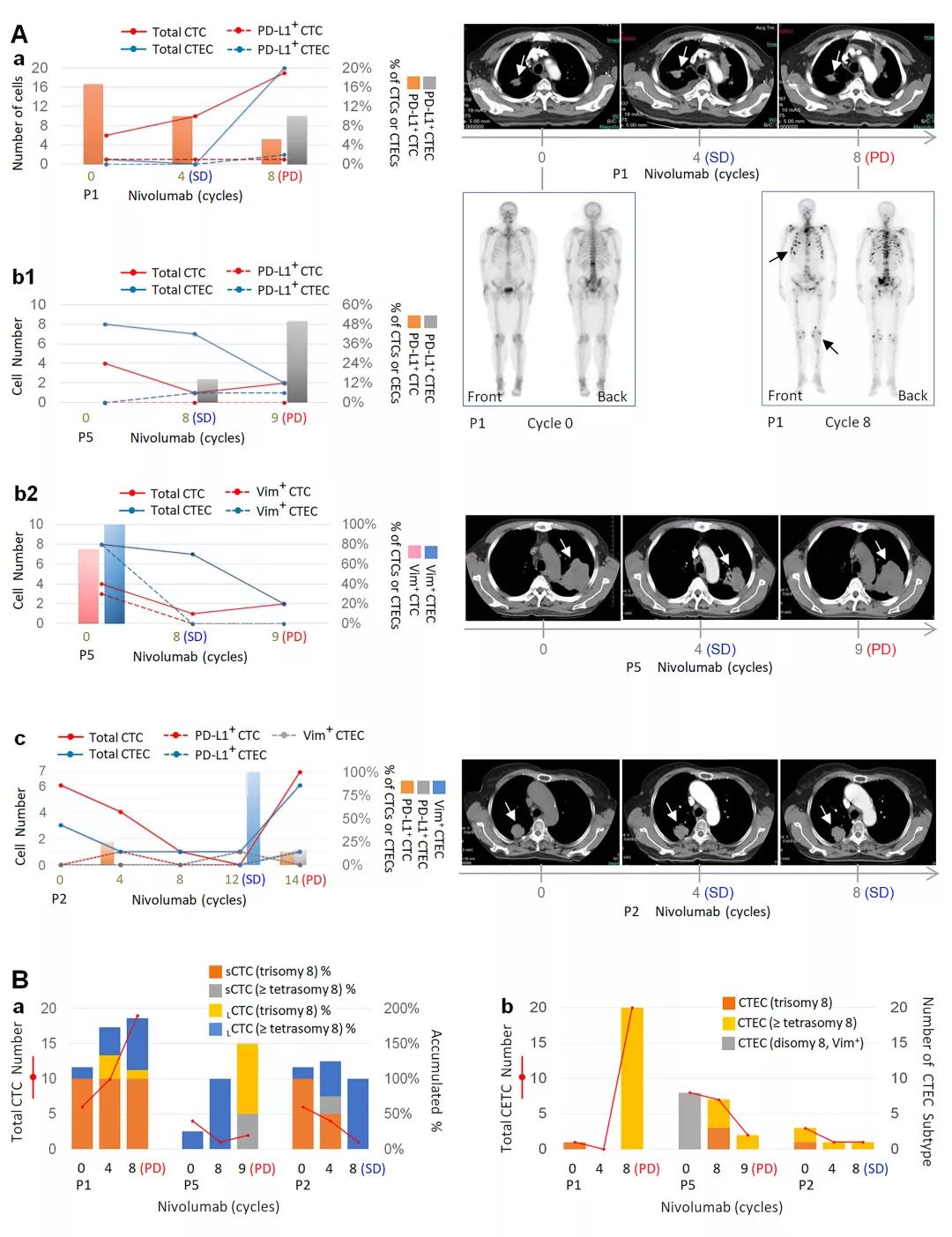 新视角pdd名单,scc在肺癌诊断中的价值
