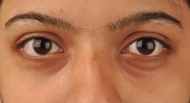 妮维雅（NIVEA）Q10晚安霜男人都爱，是女人怎能不爱？