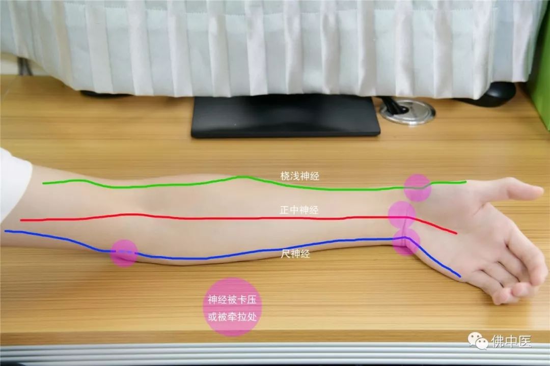 指尖发麻有针刺感看什么科室,左手拇指食指发麻针灸怎么治疗