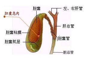 结节囊肿增生息肉形成原因是什么,内膜息肉增生怎么治