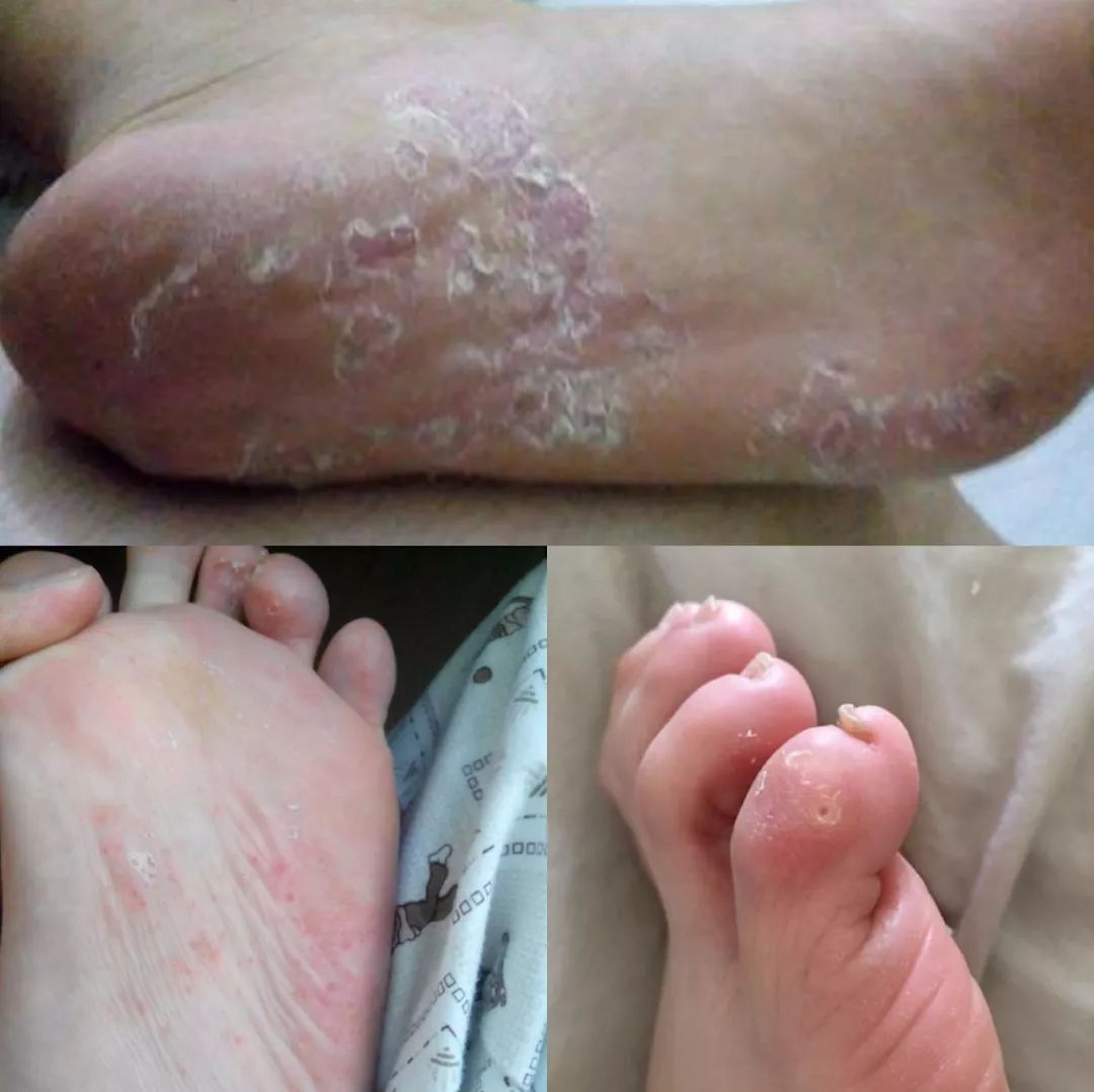 日本人吃饭都不穿鞋，熏死人了！这双耗时3年的黑科技银离子袜，美白润肤自发热，穿7天都不臭脚