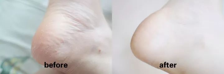 日本人吃饭都不穿鞋，熏死人了！这双耗时3年的黑科技银离子袜，美白润肤自发热，穿7天都不臭脚