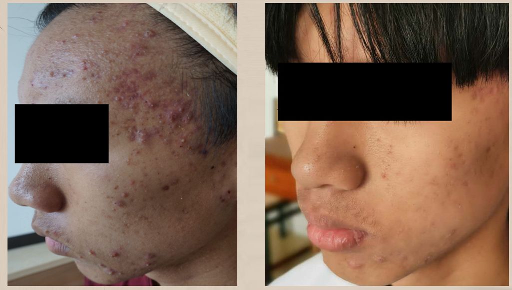 蒙自第一人民医院中医科,蒙自市中医院专家门诊