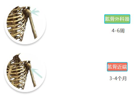 「骨科康复」骨折愈合分期和愈合时间
