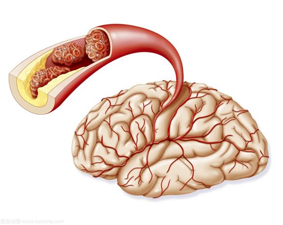 睡觉手麻什么原因,手麻的原因有哪些呢