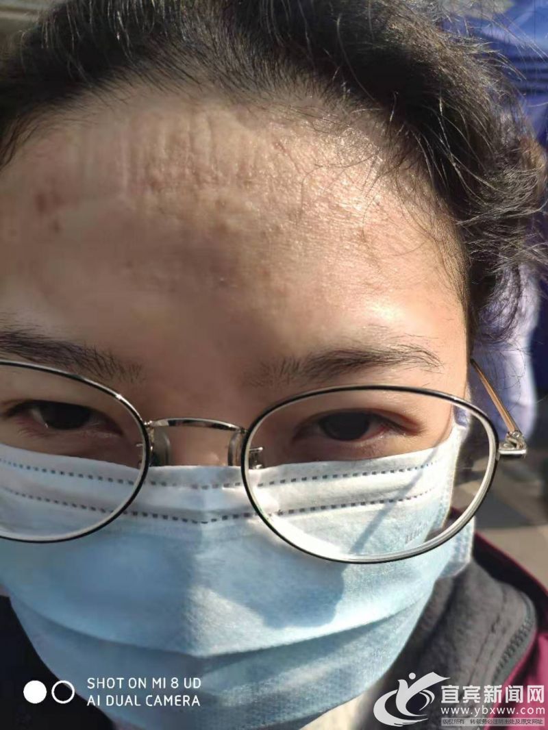 市一医院医生曹孟：一切没有想象中糟糕