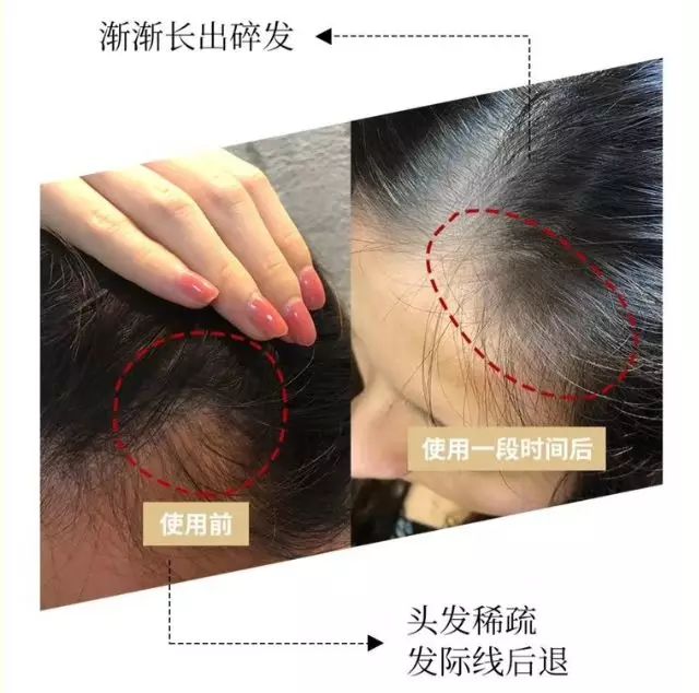 防脱发的生姜洗发水安利,官方推荐防脱洗发水