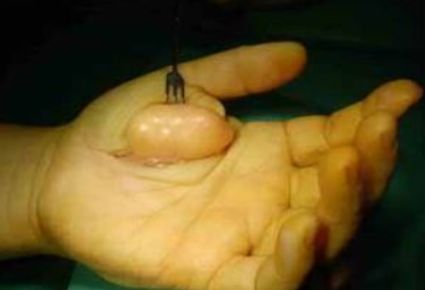 最好的罕见肿瘤药,肿瘤及罕见病目录