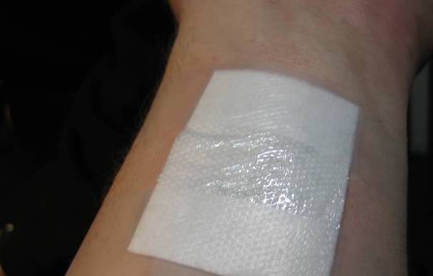 儿童开水烫伤急救处理,被开水烫伤怎么办最快最有效