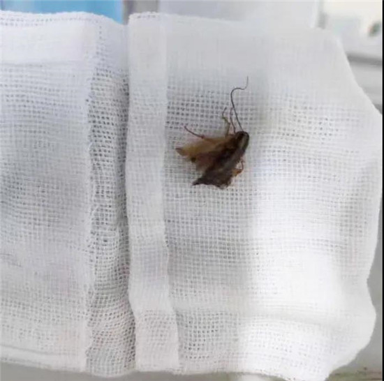 惊险！唐山妇幼耳鼻喉科一天收治7例异物患者