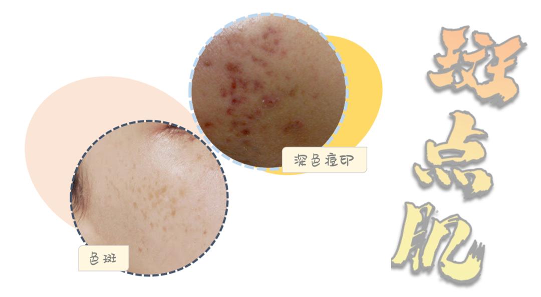 秘籍+浮力|护肤油的真香警告