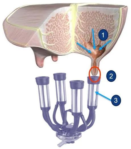 奶牛养殖技术难题及答案,奶牛接产常见问题