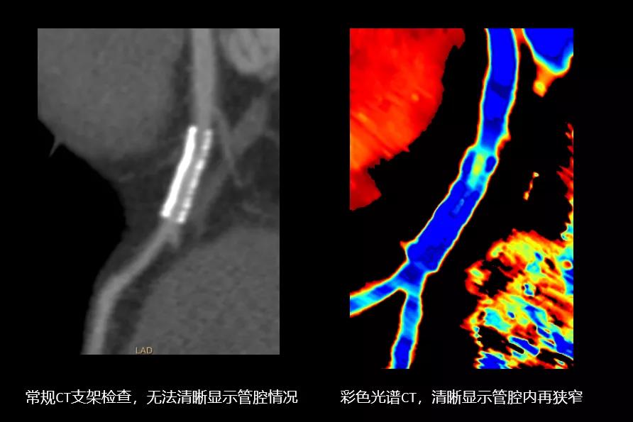 威海市中心医院引进心磁监测装置,医院新增检查多普勒彩超设备