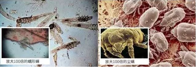 床上放个它，让螨虫绝望，让螨虫自杀，比太阳暴晒强1万倍