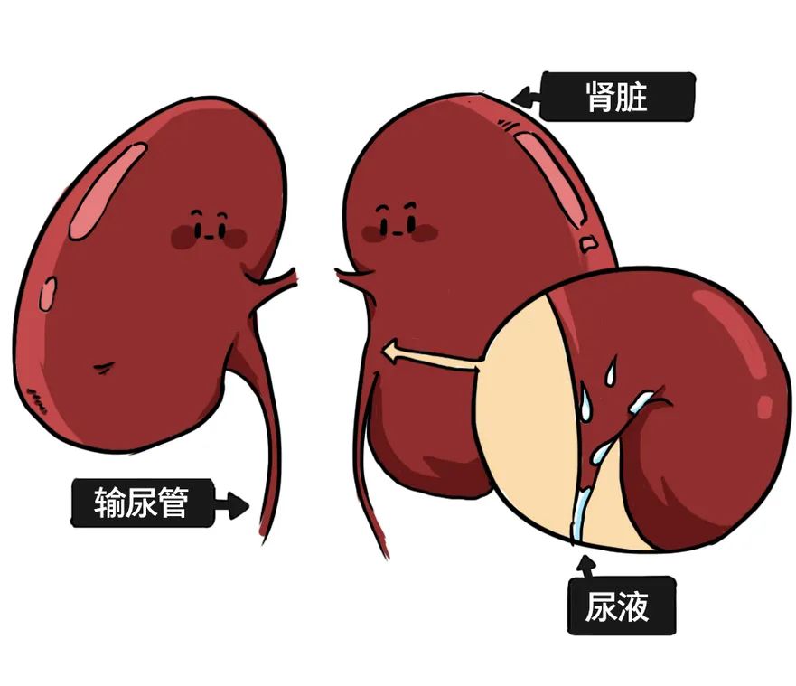 漫画科普：那些憋住的尿，最终都流向了哪里？