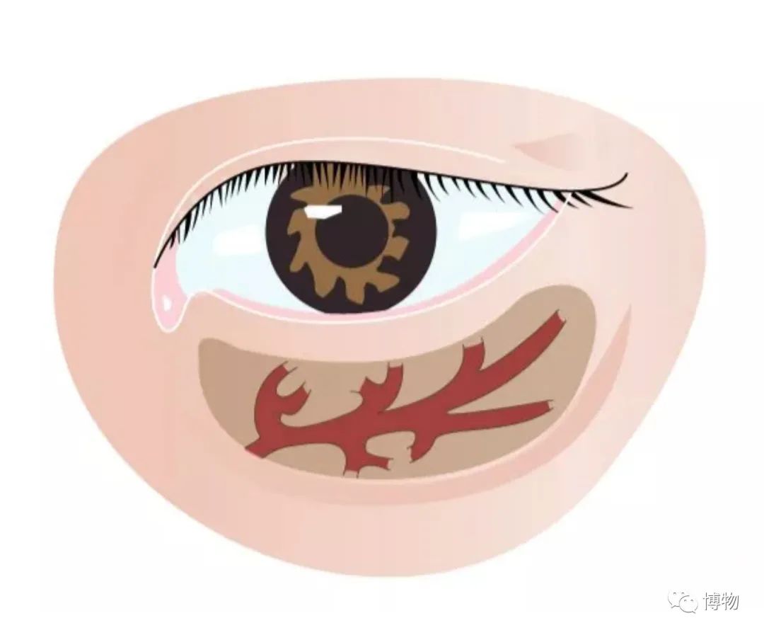 有黑眼圈适合什么颜色的卧蚕,黑眼圈适合什么颜色卧蚕