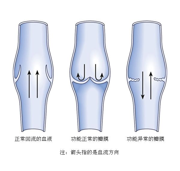 挤了颗痘痘却进了icu,挤了痘痘流了透明的水
