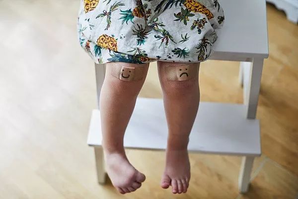 被孩子咬了需要打破伤风针吗,被小孩咬破了点皮要打破伤风针吗