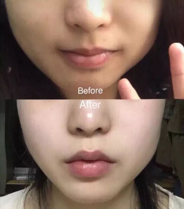 20天白到发亮,15天快速美白