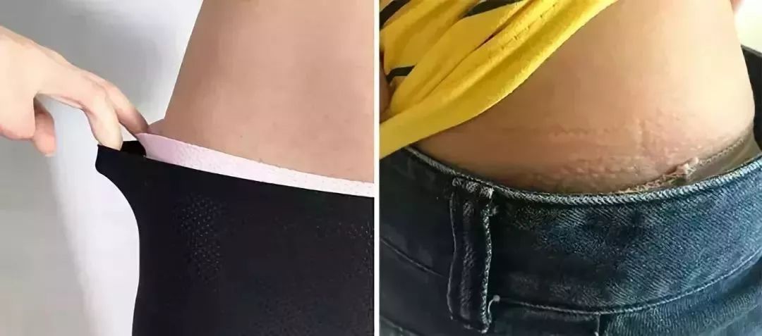 裙子里别再穿「Ta」了，现在流行这么穿