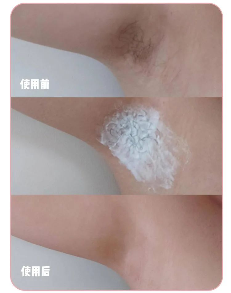 正品不刺激皮肤脱毛膏,猕猴桃脱毛膏哪种最好