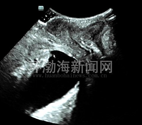 唐山工人医院免费导诊,唐山工人医院看什么病最好