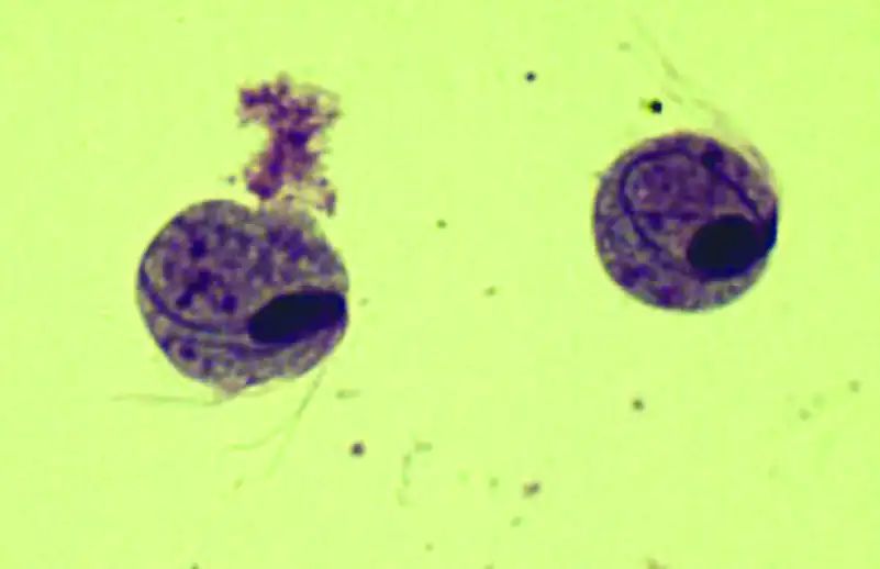 尿液中的有形成分红细胞,尿液中常见的有形成分