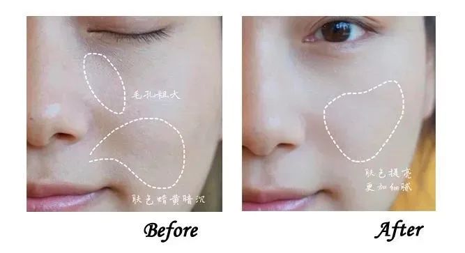 澶忓ぉ浼戦棽濂楄,澶忔棩8浠跺