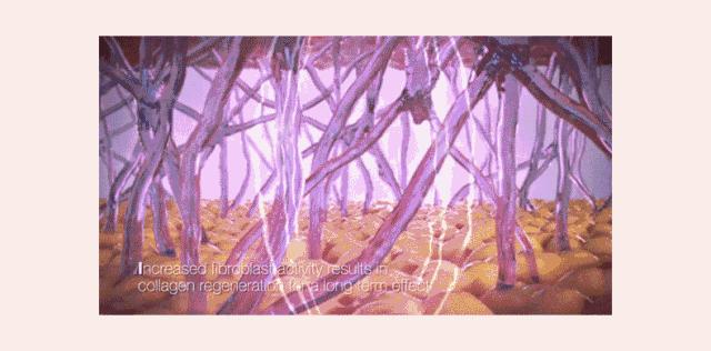 如何笑不长皱纹,70岁以上不长皱纹怎么办